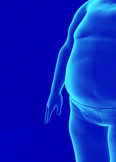 NUB_DPJ_Bayer-Para-Homens_Artigos_Banners-Saude-MasculinaSíndrome-Metabólica_Destaque